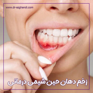 زخم دهان حین شیمی ‌درمانی + دکتر سمیرا ازقندی
