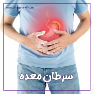 سرطان معده + دکتر سمیرا ازقندی