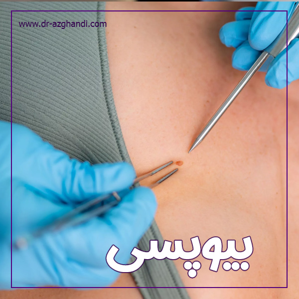 بیوپسی + دکتر سمرا ازقندی