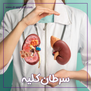 سرطان کلیه + دکتر سمیرا ازقندی