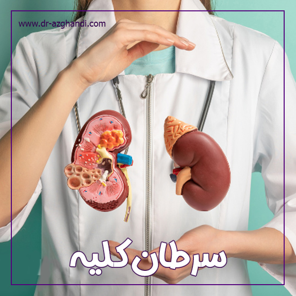 سرطان کلیه + دکتر سمیرا ازقندی
