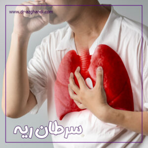 سرطان ریه + دکتر سمیرا ازقندی