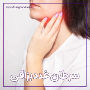 سرطان غدد بزاقی + دکتر سمیرا ازقندی