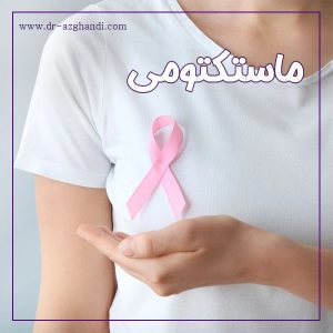 ماستکتومی یا جراحی تخلیه پستان + دکتر سمیرا ازقندی