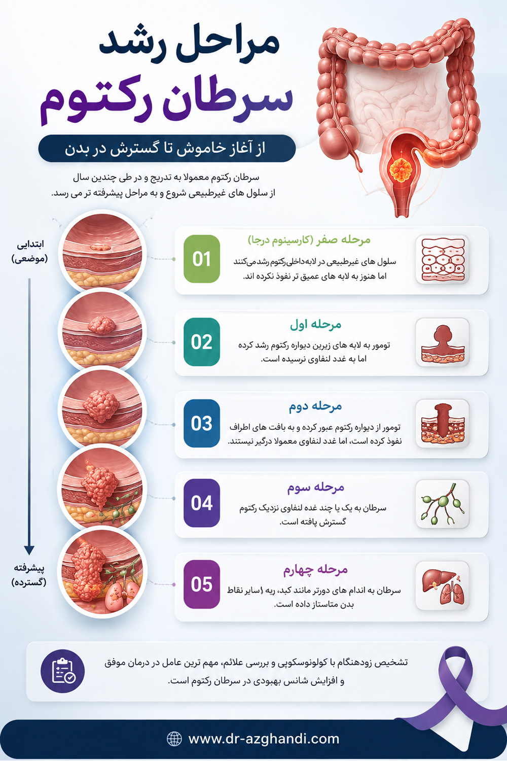 سرطان رکتوم + دکتر سمیرا ازقندی