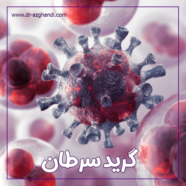 گرید سرطان + دکتر سمیرا ازقندی