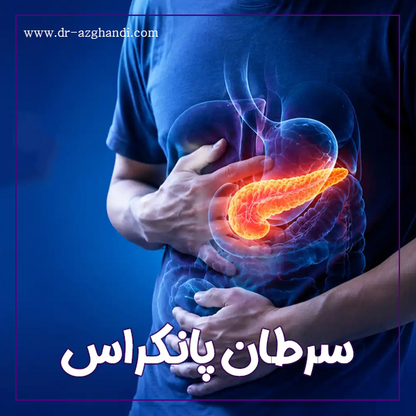سرطان پانکراس + دکتر سمیرا ازقندی