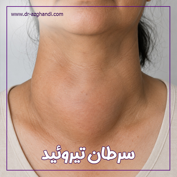 درباره سرطان تیروئید بیشتر بدانید ! 3 thyroid cancer 6 سرطان تیروئید + دکتر سمیرا ازقندی