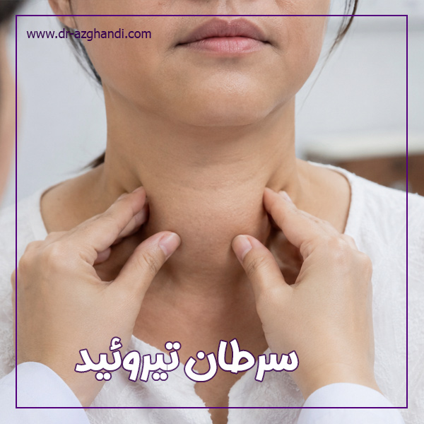 درباره سرطان تیروئید بیشتر بدانید ! 1 thyroid cancer 8 سرطان تیروئید + دکتر سمیرا ازقندی