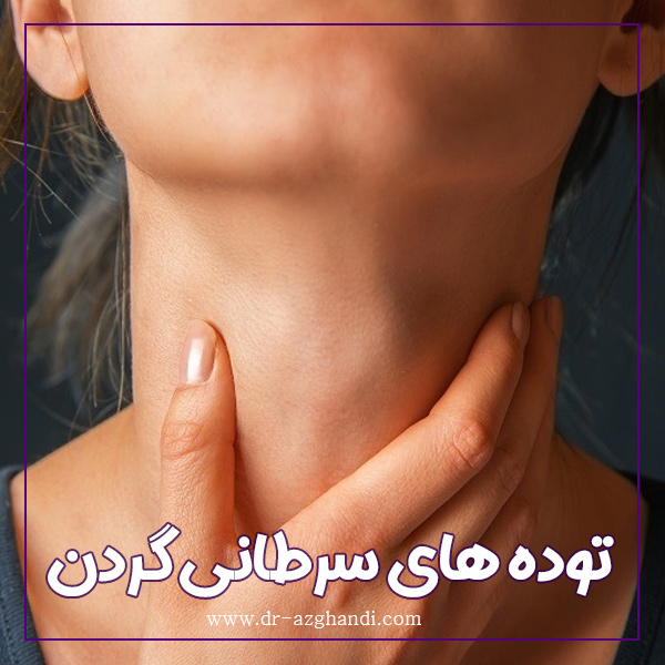 توده گردن چه زمانی خطرناک است؟ بررسی علائم سرطان 3 malignant neck masses 3 توده های سرطانی گردن + دکتر سمیرا ازقندی
