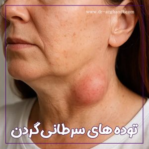 توده های سرطانی گردن + دکتر سمیرا ازقندی