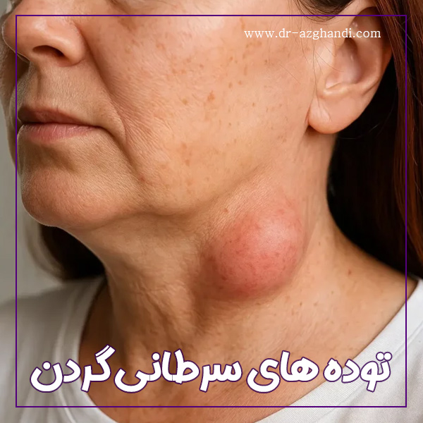 توده های سرطانی گردن + دکتر سمیرا ازقندی