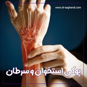 پوکی استخوان و سرطان + دکتر سمیرا ازقندی