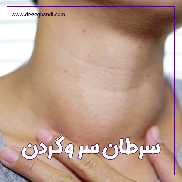 سرطان سر و گردن + دکتر سمیرا ازقندی