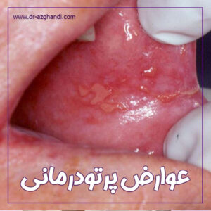 عوارض بعد از شیمی درمانی + دکتر سمیرا ازقندی